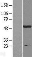 NBL1-11886 - Inositol Hexakisphosphate Kinase 2 Lysate