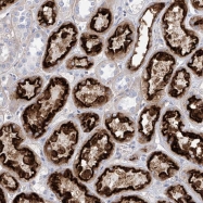 NBP1-90188 - ITGA9 / Integrin alpha-9