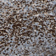 NBP1-88128 - CD18 / ITGB2