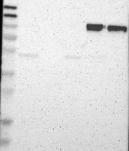 NBP1-88128 - CD18 / ITGB2
