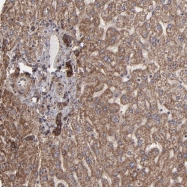 NBP1-88117 - Integrin beta-5 / ITGB5