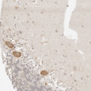 NBP1-87447 - Integrin beta-8 / ITGB8