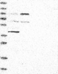 NBP1-87447 - Integrin beta-8 / ITGB8
