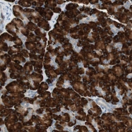 NBP1-82473 - ITGBL1