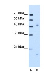NBP1-59168 - ITGBL1