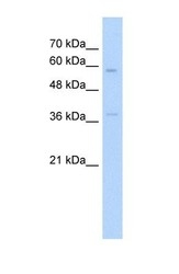 NBP1-59169 - ITGBL1