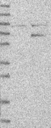 NBP1-82473 - ITGBL1