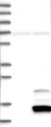 NBP1-89809 - ISG15 / G1P2