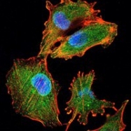 NBP1-51627 - Interleukin-34 / IL34