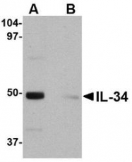 NBP1-76356 - Interleukin-34 / IL34