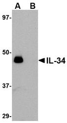 NBP1-76357 - Interleukin-34 / IL34