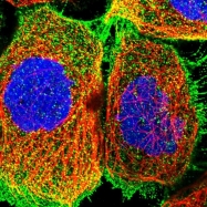 NBP1-87806 - Intersectin-1 / ITSN1