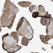 NBP1-87806 - Intersectin-1 / ITSN1