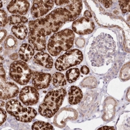NBP1-89610 - Intersectin-2 / ITSN2