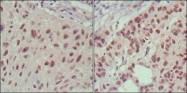 NBP1-47537 - Islet-1 / ISL1