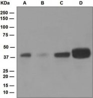 NBP1-95731 - Islet-1 / ISL1