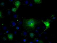 NBP1-47804 - Isocitrate dehydrogenase / IDH