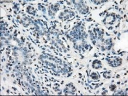 NBP1-47804 - Isocitrate dehydrogenase / IDH
