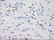 NBP1-47804 - Isocitrate dehydrogenase / IDH