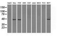 NBP1-47804 - Isocitrate dehydrogenase / IDH