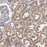 NBP1-86337 - Jagged-2 / JAG2