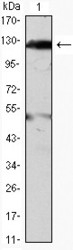 NBP1-47488 - Tyrosine-protein kinase JAK2