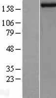 NBL1-12099 - JARID1B Lysate