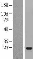 NBL1-12101 - JDP2 Lysate