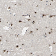 NBP1-81382 - JHDM1D