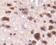 NBP1-49601 - KDM3A / JHDM2A