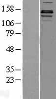 NBL1-12102 - JHDM2A Lysate