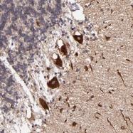 NBP1-87886 - JM4 / PRAF2