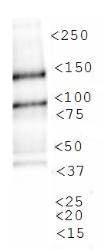 NBP1-49601 - KDM3A / JHDM2A