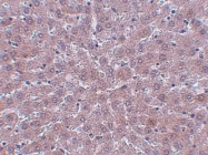 NBP1-77071 - JMJD1B / KDM3B