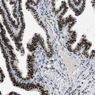 NBP1-88256 - JMJD1B / KDM3B