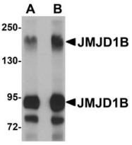 NBP1-77071 - JMJD1B / KDM3B