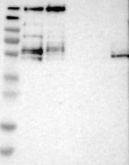 NBP1-88256 - JMJD1B / KDM3B
