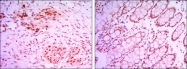 NBP1-51642 - JMJD2A / KDM4A