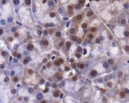 NBP1-49602 - JMJD2A / KDM4A