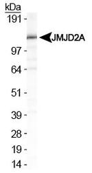 NBP1-49602 - JMJD2A / KDM4A