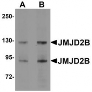 NBP1-76314 - JMJD2B / KDM4B