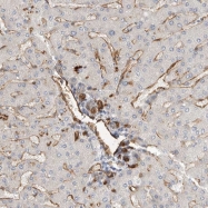 NBP1-94032 - JMJD4