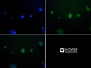 NBP1-71693 - JMJD6 / PTDSR