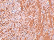 NBP1-77075 - JMJD6 / PTDSR