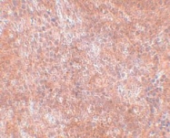 NBP1-77076 - JMJD8