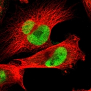 NBP1-83076 - Junctophilin-1 / JHP1