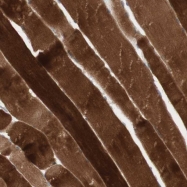 NBP1-83075 - Junctophilin-1 / JHP1