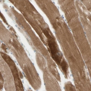 NBP1-83076 - Junctophilin-1 / JHP1