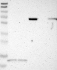 NBP1-83075 - Junctophilin-1 / JHP1