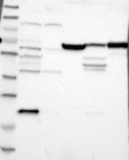 NBP1-83076 - Junctophilin-1 / JHP1